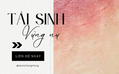 NHỮNG DẤU HIỆU MÀU LÊN CHUẨN SAU PHUN HỒNG